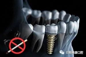 电子烟也不行?